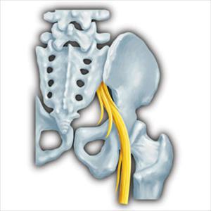 Sciatic Nerve Cushion 