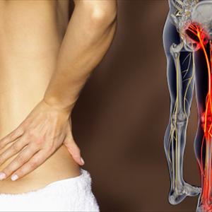 Yoga Poses For Sciatica - 3 Questions On Sciatica - Do You Know The "Right" Answers?
