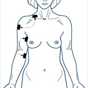 Greater Sciatic Foramen - Back Pain, Muscle And Joint Pain, Sciatica Relief With Tibetan Applicator