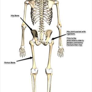 Sciatic Neuritis Disability - Treatment Of Sciatica -- Lying, Sitting, And Standing