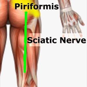 Stretches For Sciatic Nerve Pain - Certified Rolfing 10 Series- Treating Sciatica And Sleeve