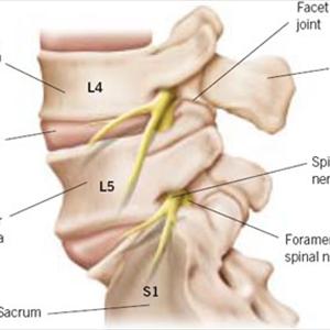 Sciatic Nerve Cushion 