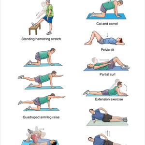  The Best & Quickest Exercise To Relieve Sciatica