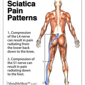 Exercises To Help Sciatica - Top 7 Tips To Treat And Prevent Sciatica