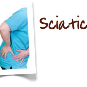 Sciatic Nerve Diagram Guide - Burning Limbs: The Truth About Sciatica