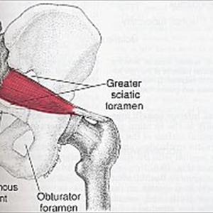 Bilateral Sciatic Nerve Pain - Exercises For Sciatica - What Causes Back Pain?