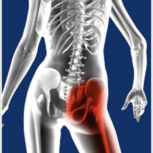 Sciatica Notch - Sciatica Pain - Causes And Symptoms